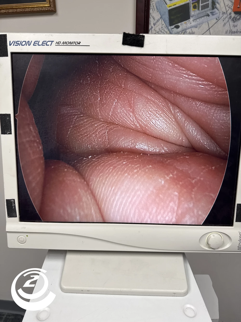 Stryker 0502-103-030