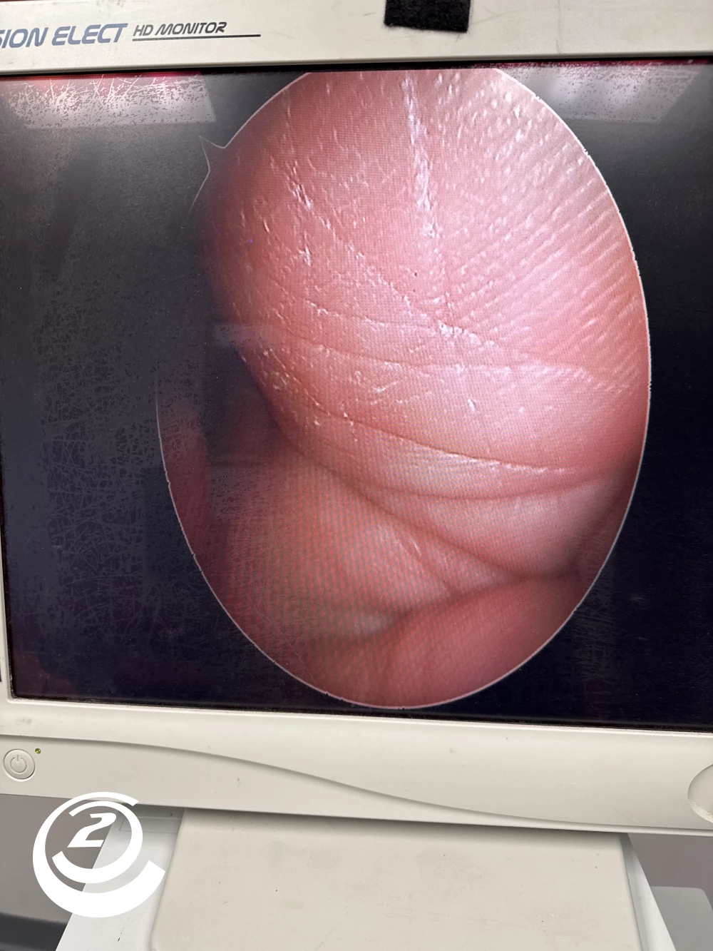 Stryker 0502-990-070