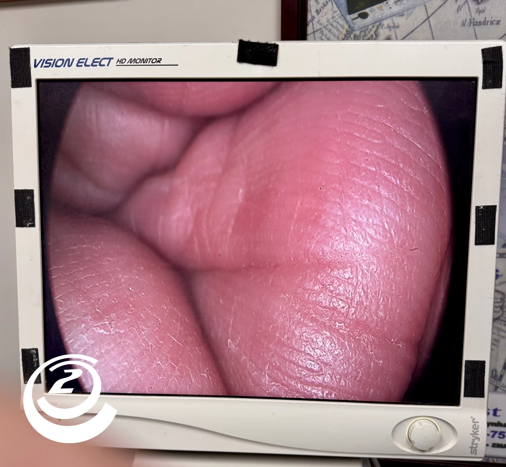 Stryker 0502-948-010 SPY