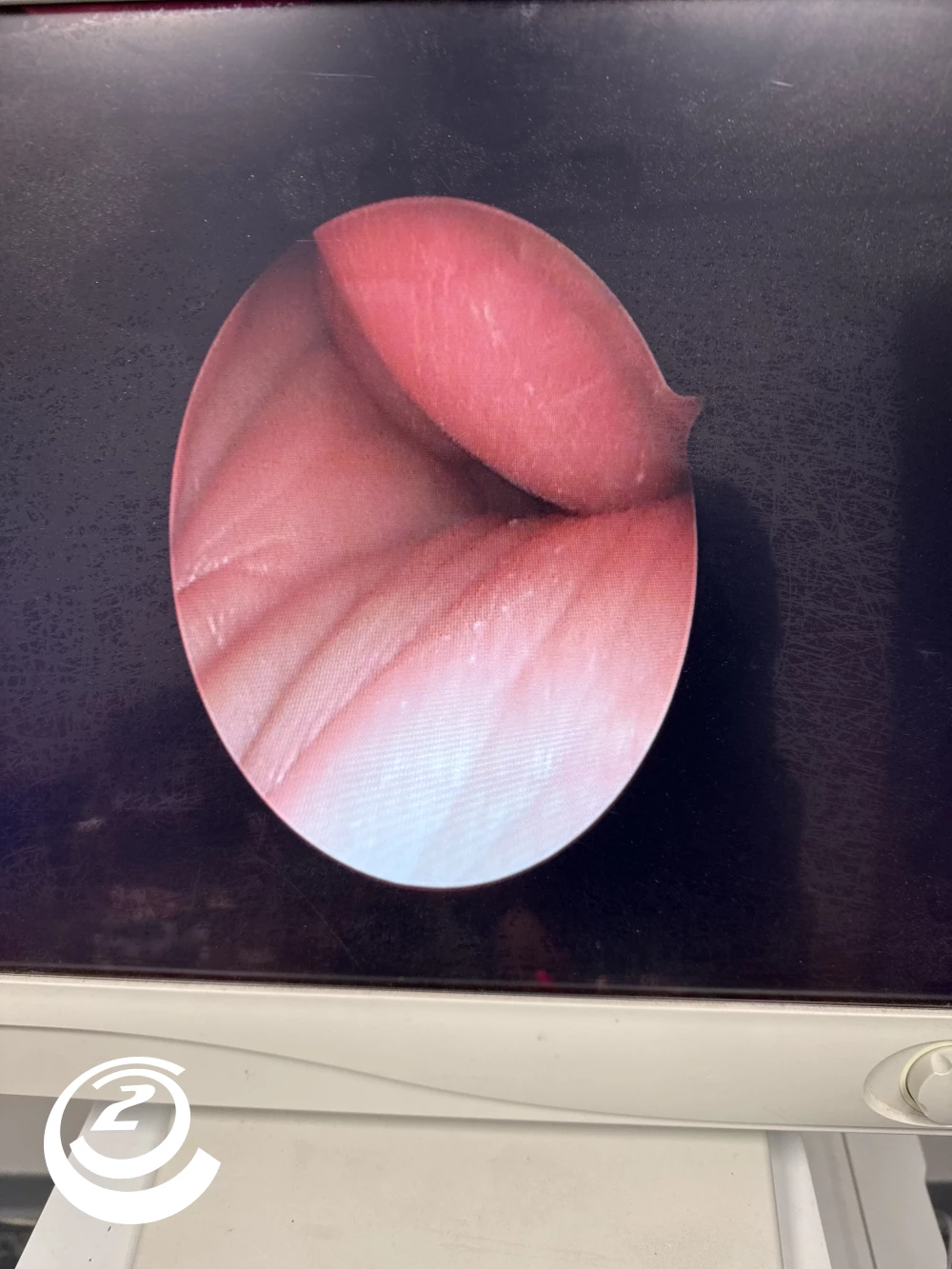 Stryker 0502-820-030