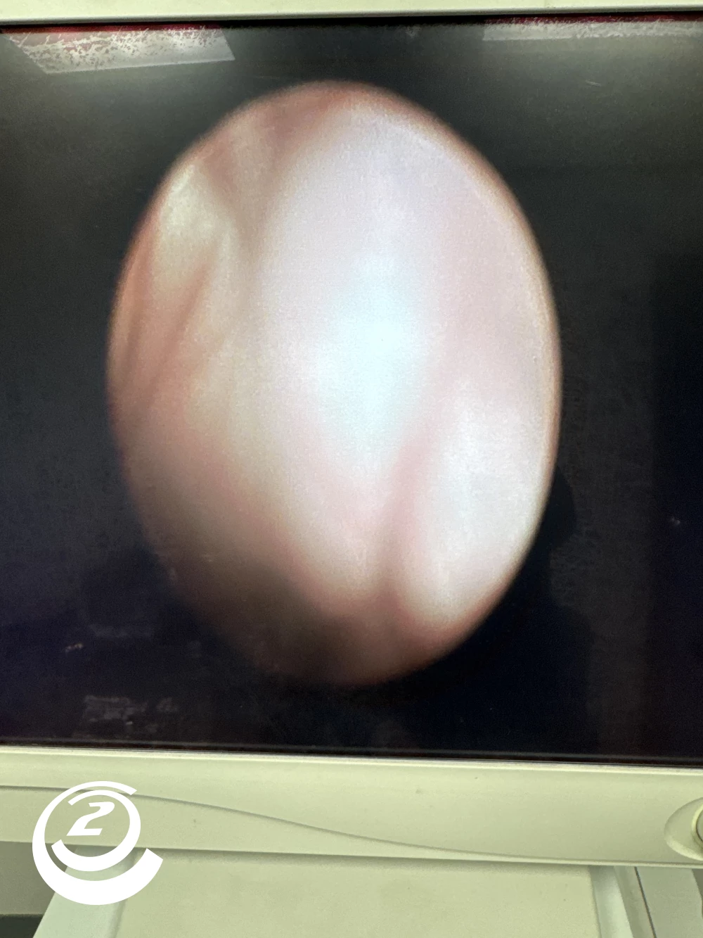 Stryker 0502-826-030