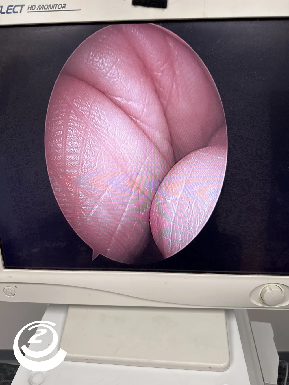 Stryker 502-904–070