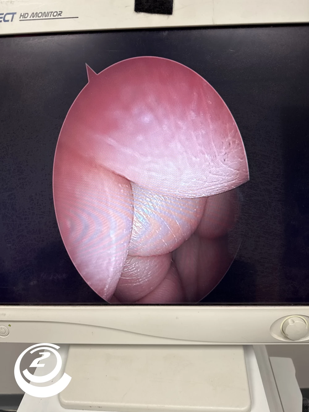 Stryker 502-904–070