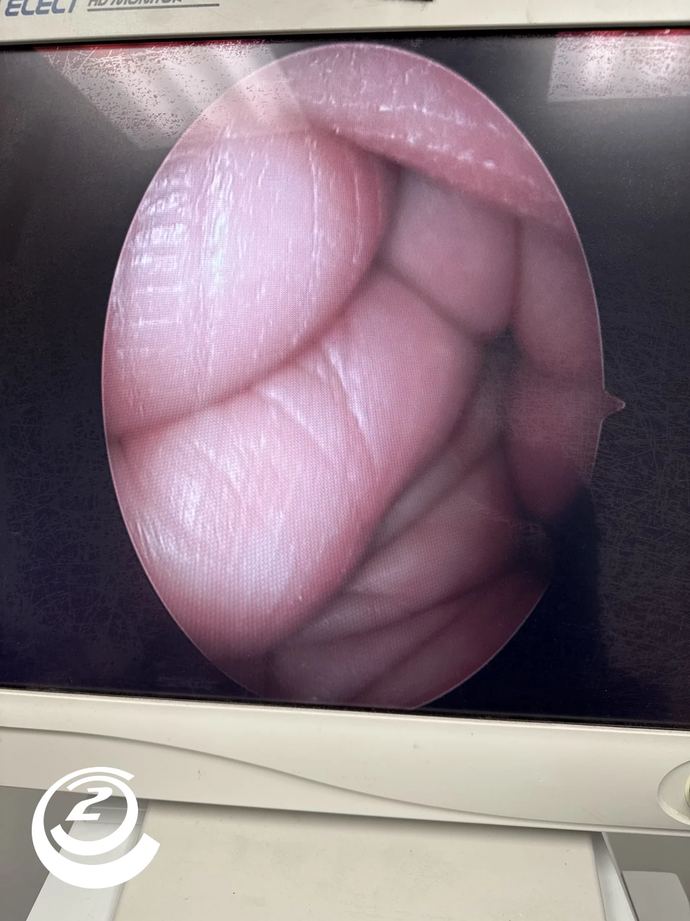 Stryker 0502-904-030