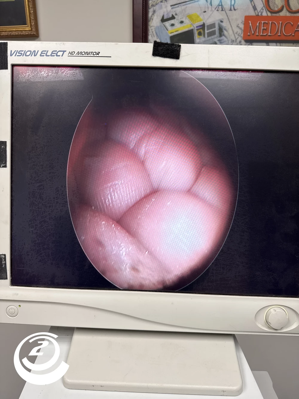 Stryker 0502-990-070