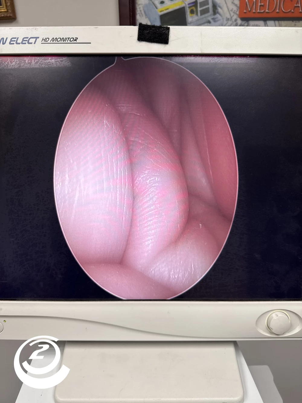 Stryker 0502-990-012