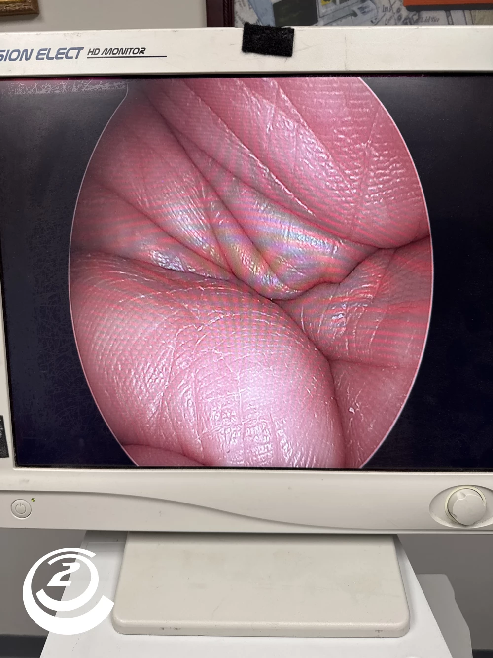 Stryker 0502-991-012