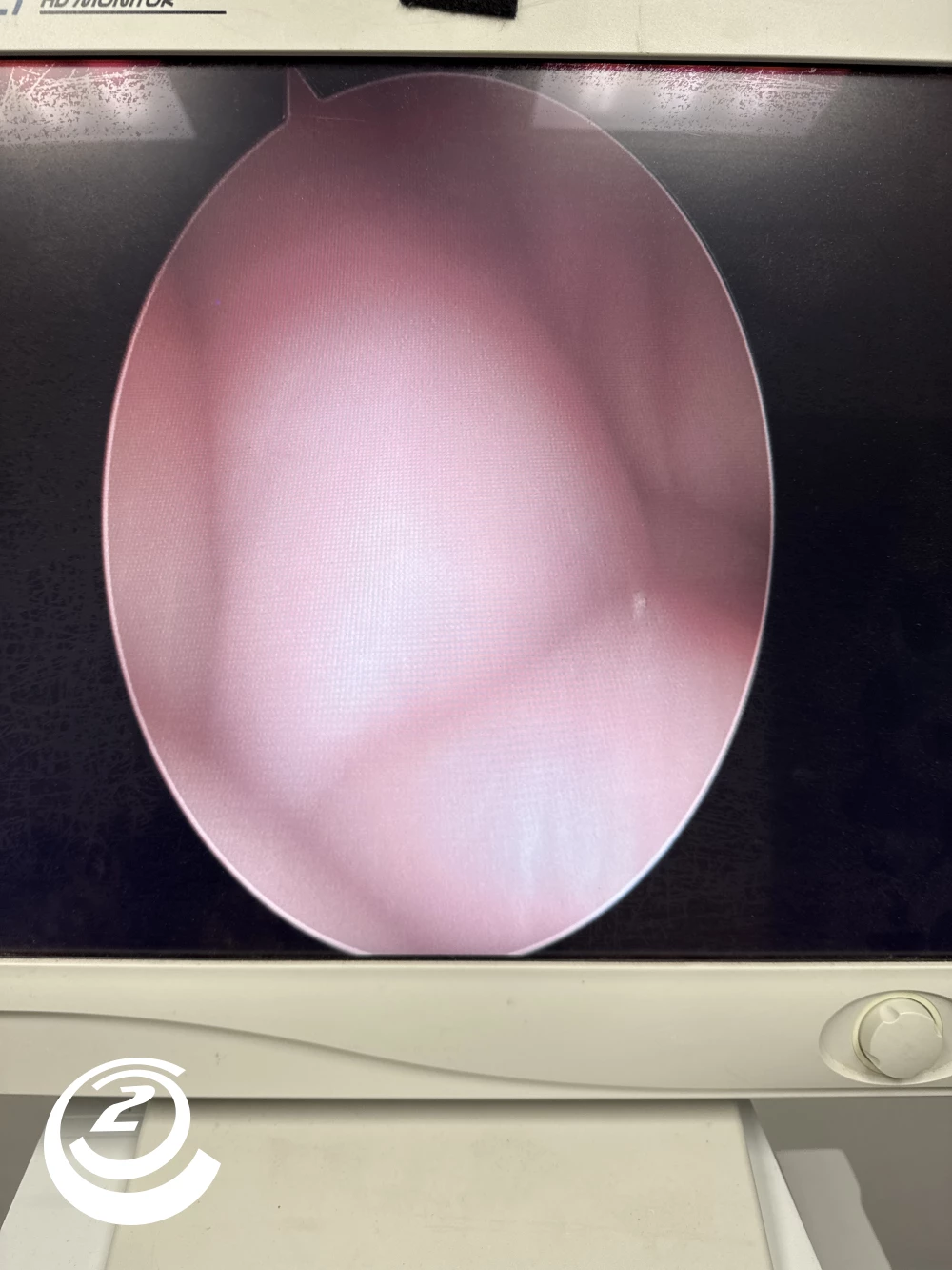 Stryker 0502-990-030