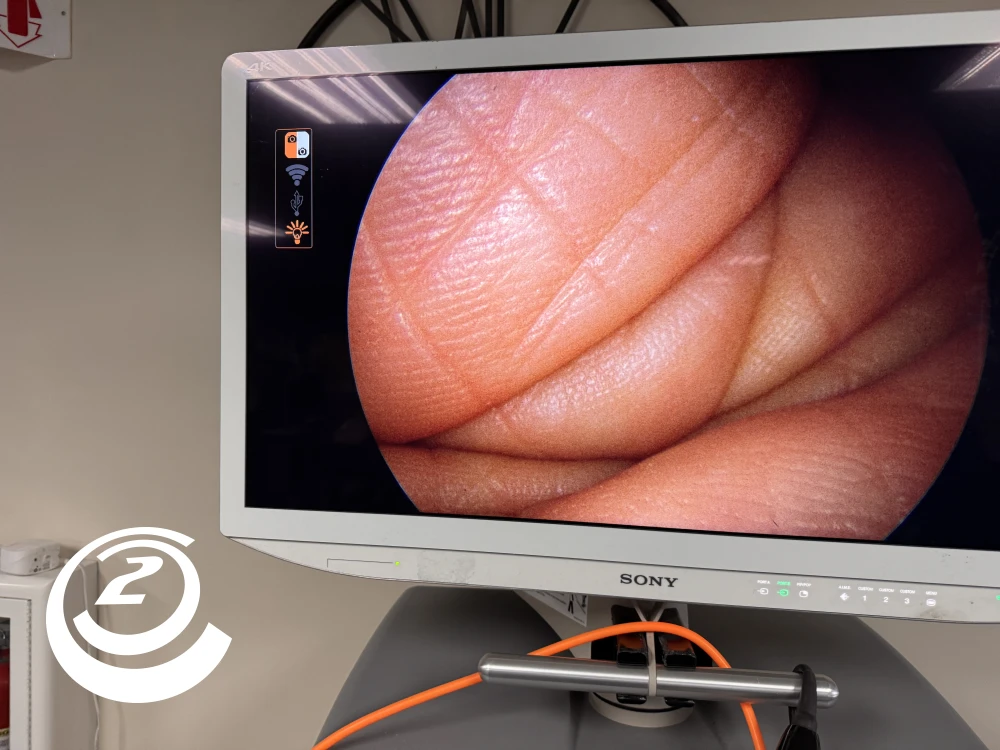 Smith & Nephew 72202087