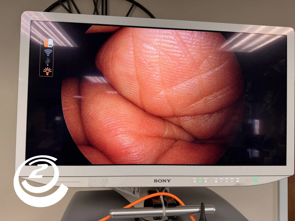 Smith & Nephew 72202087