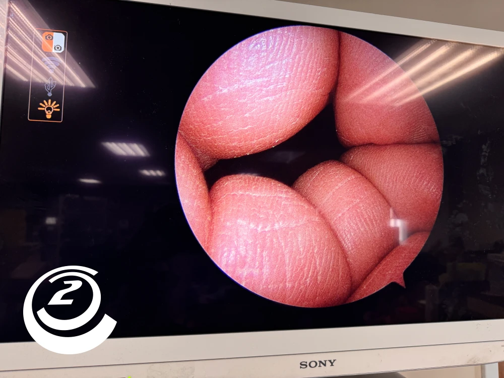 Smith & Nephew 72205058