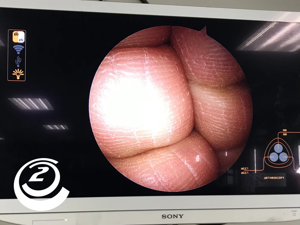 Smith & Nephew 72205058