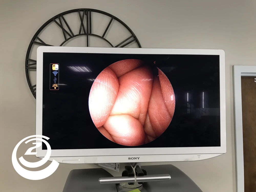 Smith & Nephew 72205058