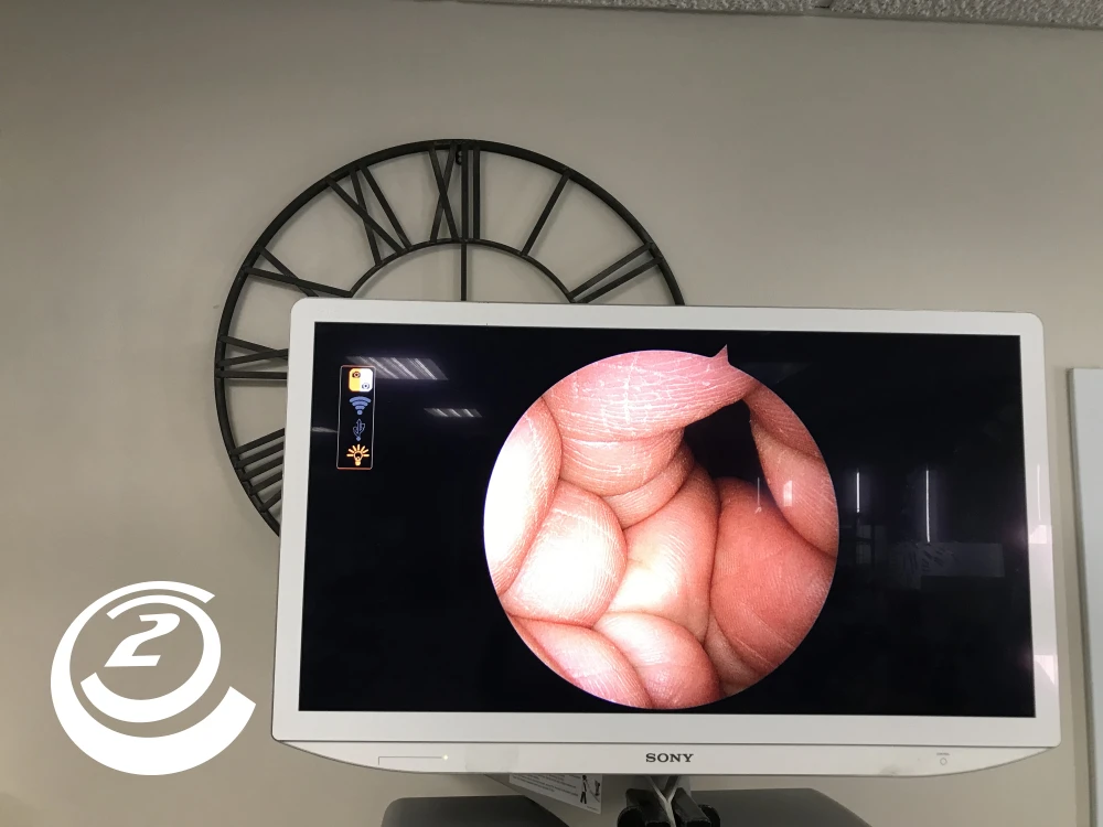 Smith & Nephew 72205058