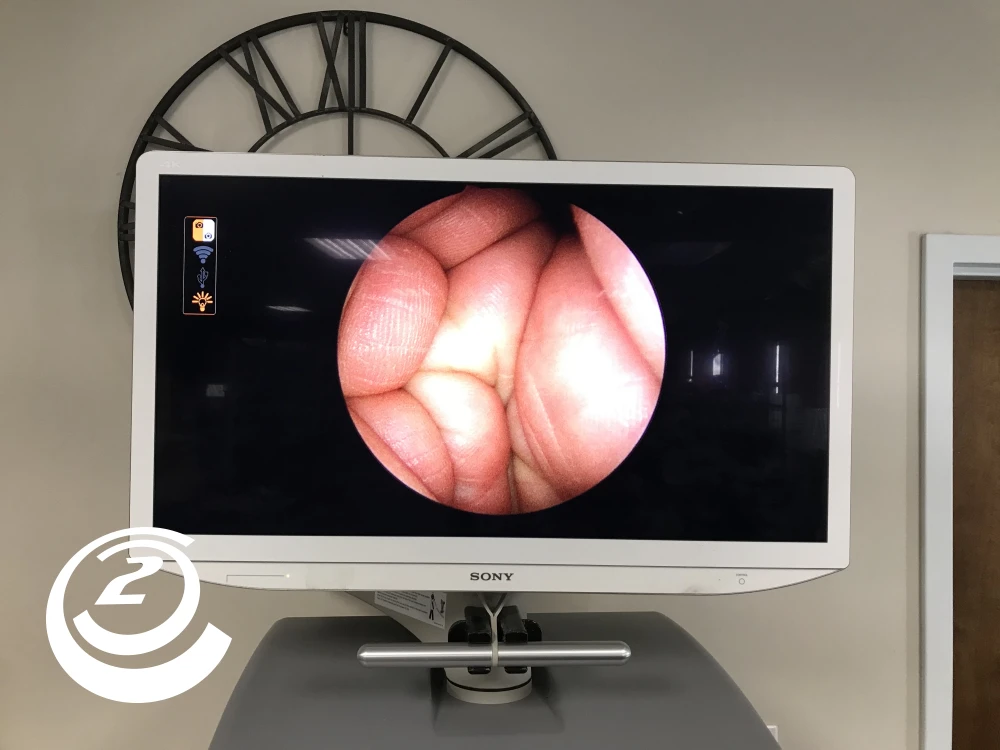 Smith & Nephew 72205058