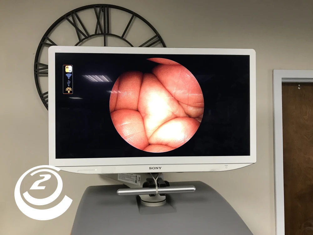 Smith & Nephew 72205058