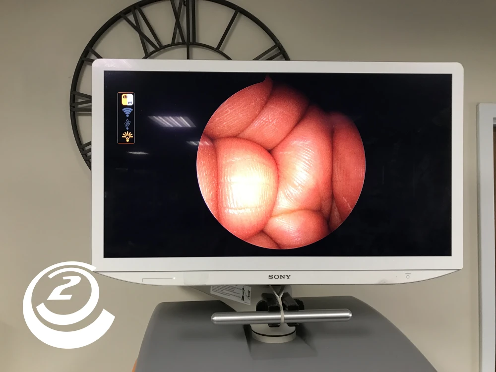 Smith & Nephew 72205058