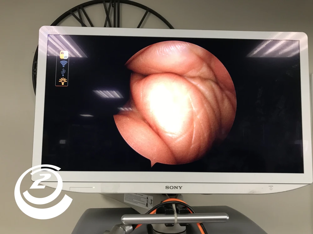 Smith & Nephew 72205058