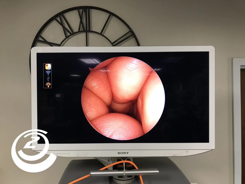 Smith & Nephew 72205058