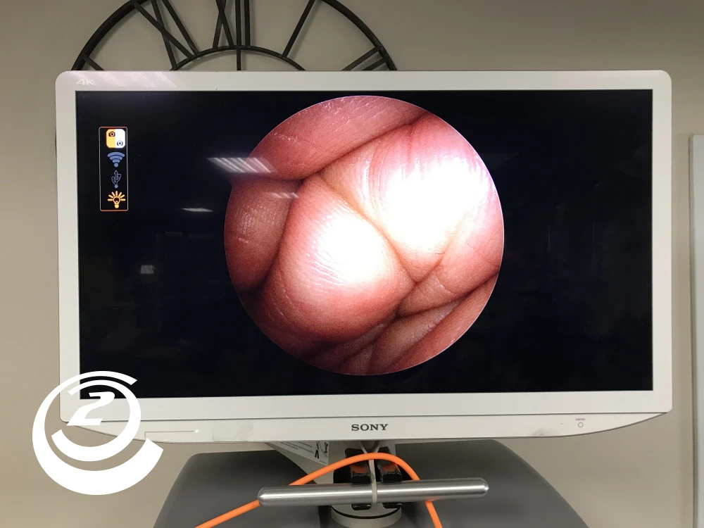 Smith & Nephew 72205058