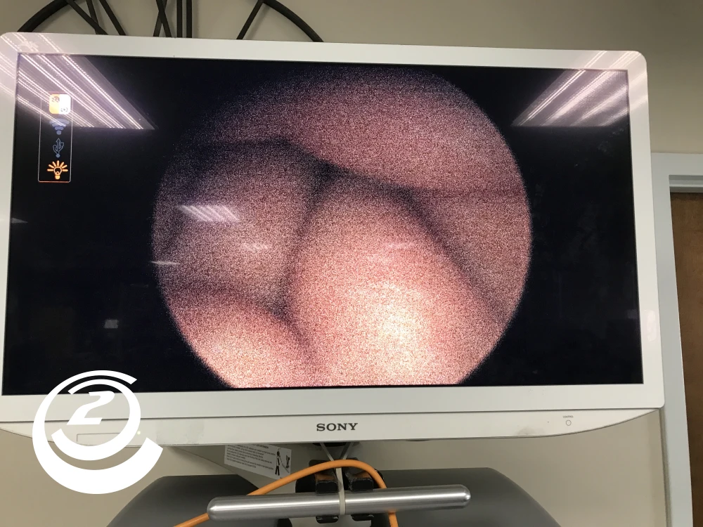 Smith & Nephew 7208133