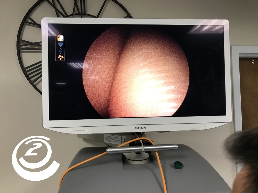 Smith & Nephew 7208133