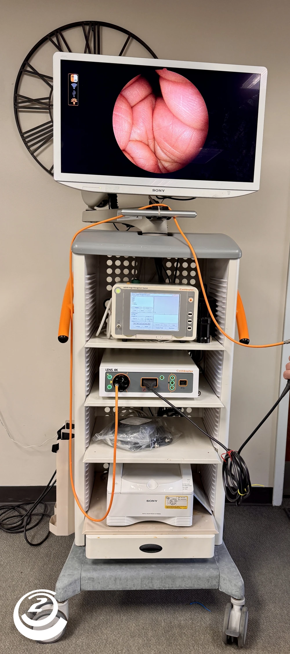 Smith & Nephew Lens 4K