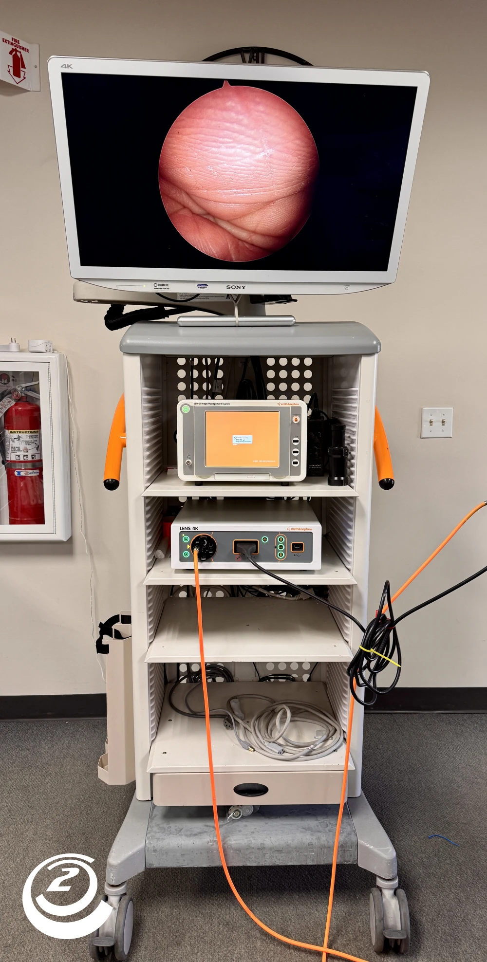 Smith & Nephew Lens 4K