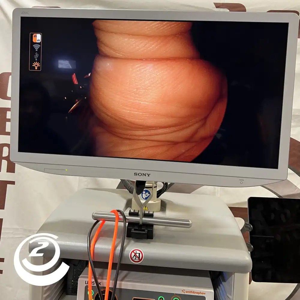 Smith & Nephew LENS 4K Endoscopy system