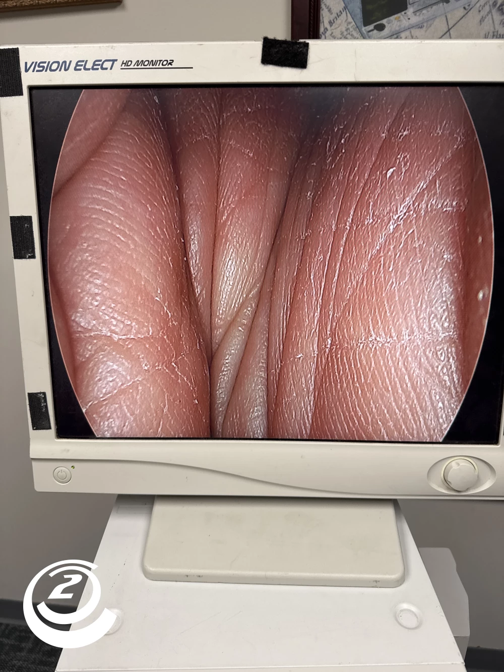 Stryker 0502-103-030