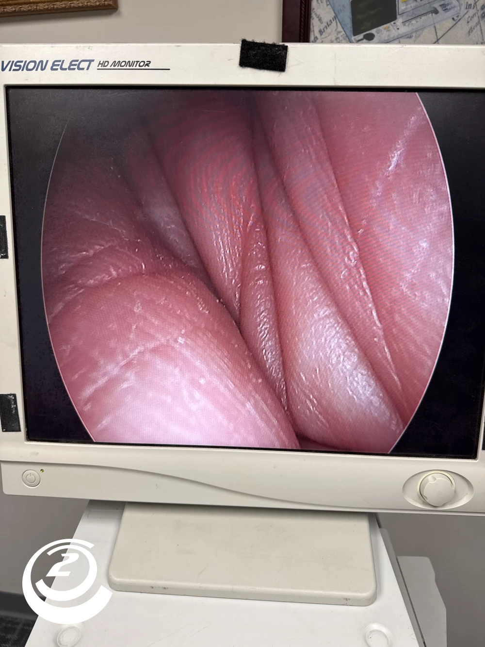 Stryker 0502-503-030