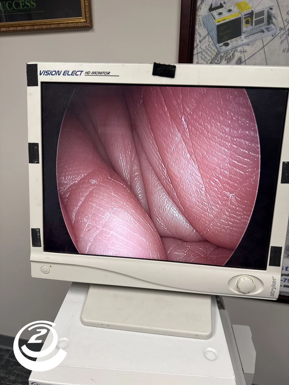 Stryker 0502-503-030