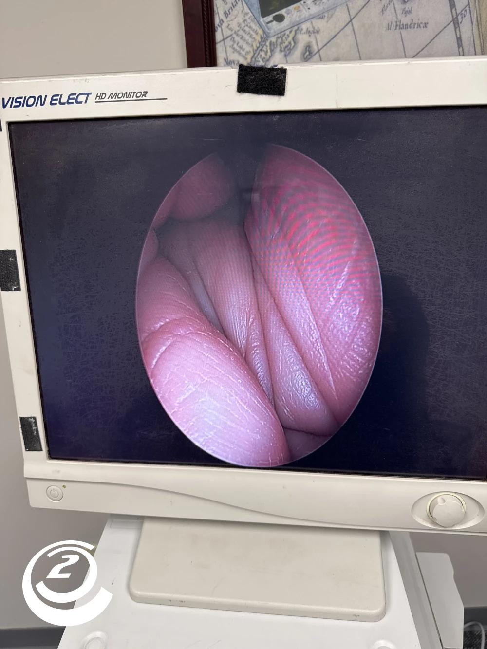 Stryker 0502-904-030