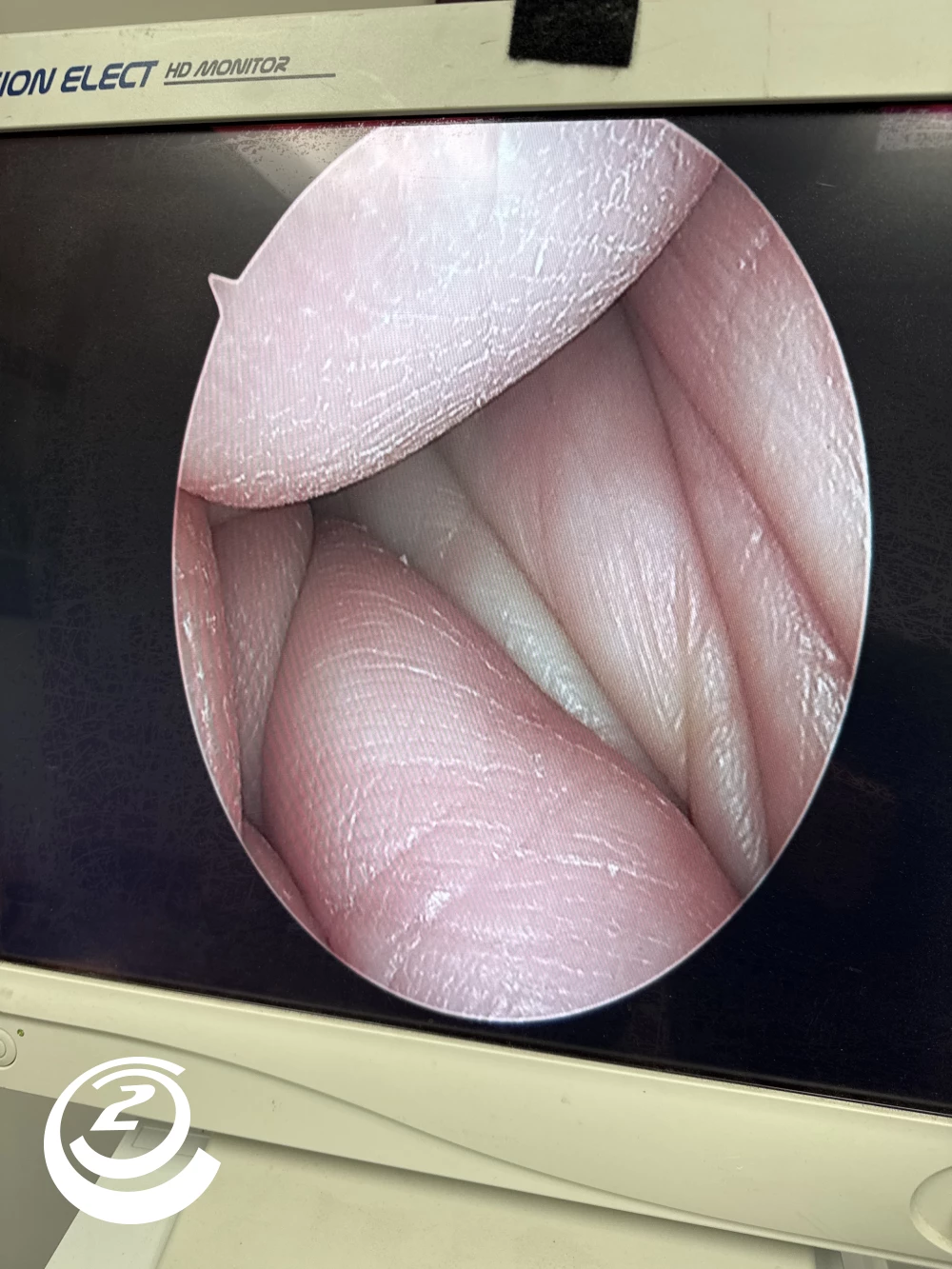 Stryker 0502-904-030