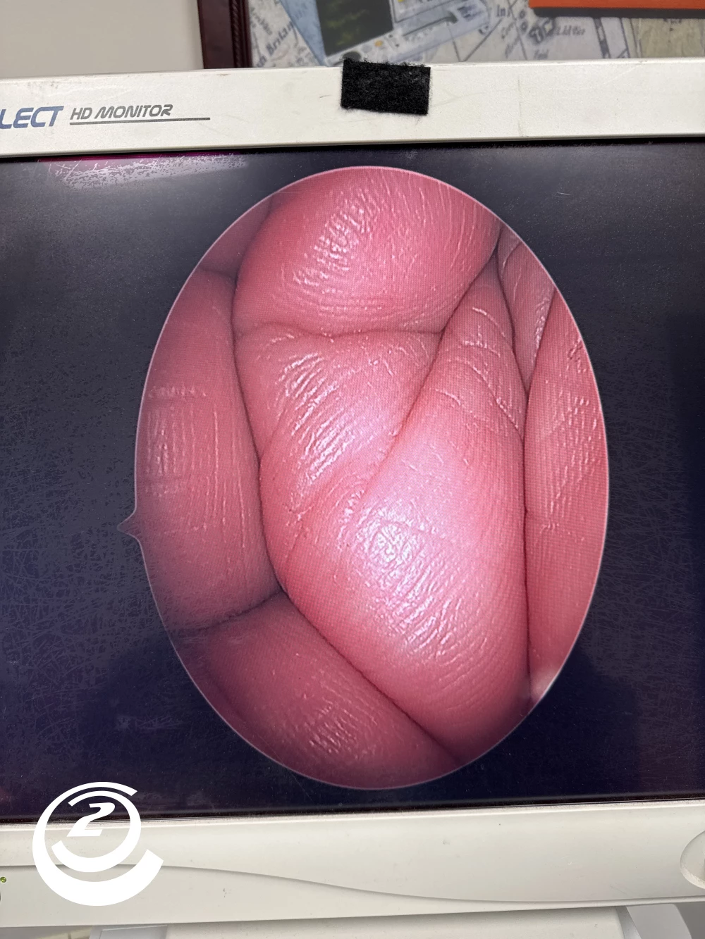 Stryker 0502-904-030