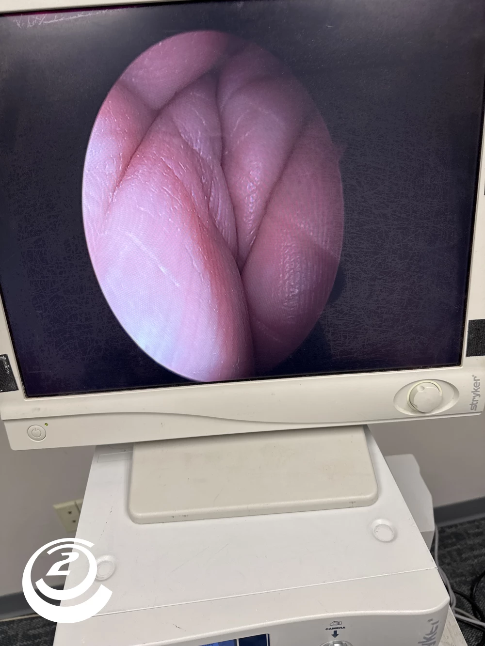 Stryker 0502-904-030