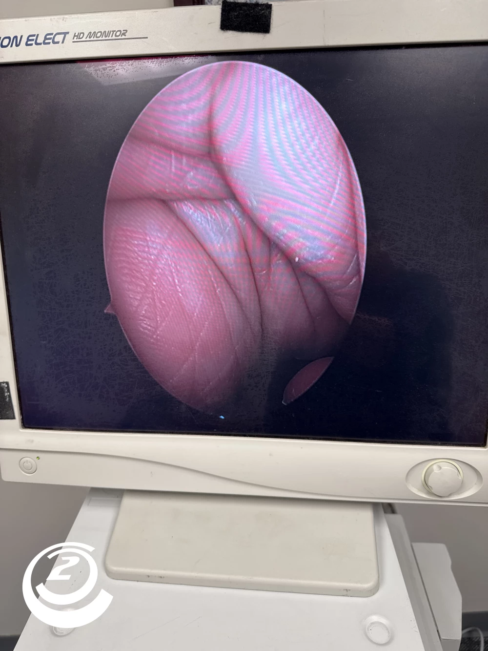 Stryker 0502-904-030