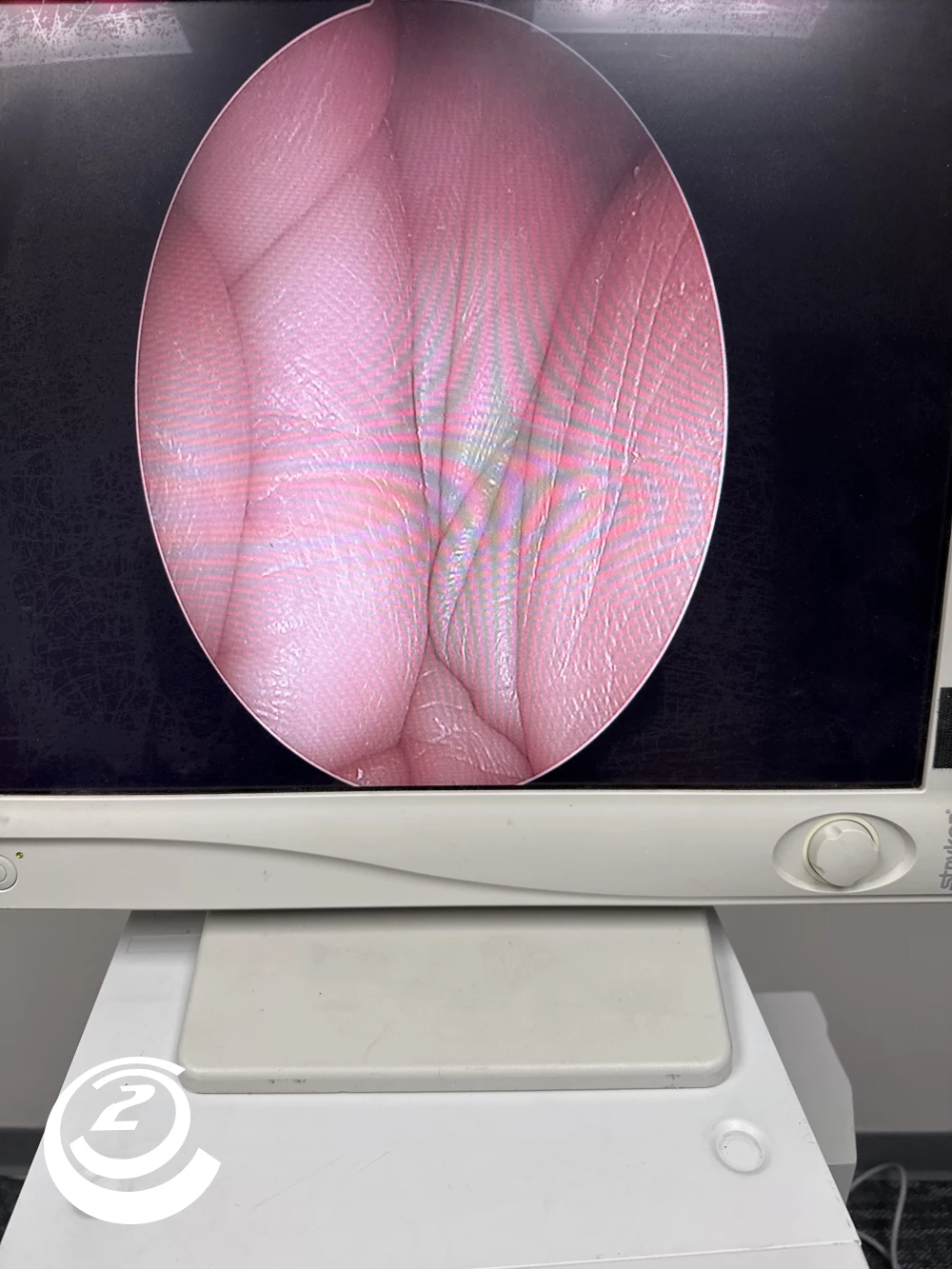 Stryker 0502-990-070