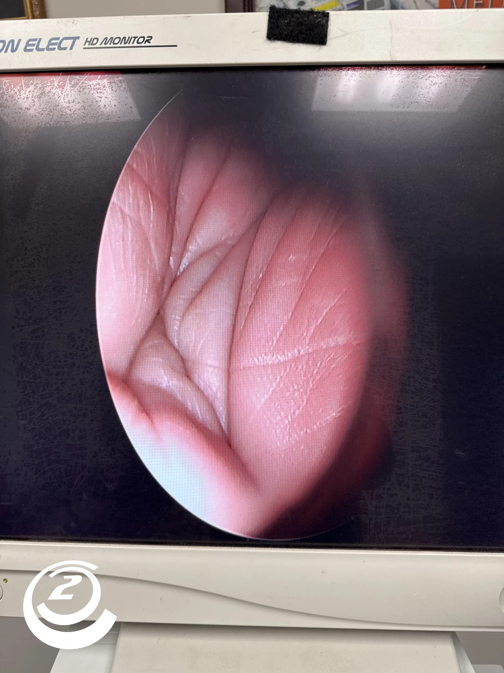 Stryker 0502-990-070