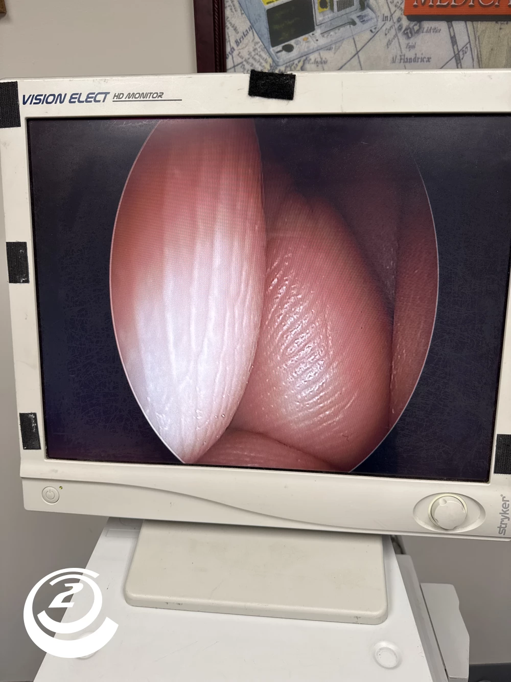 KARL STORZ Hopkins II 27005CA