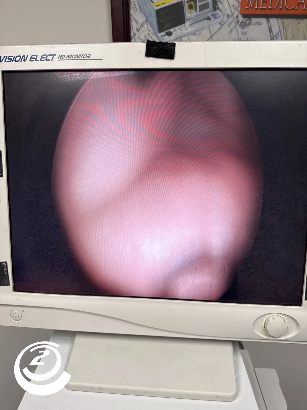 KARL STORZ Hopkins II 27005 AA