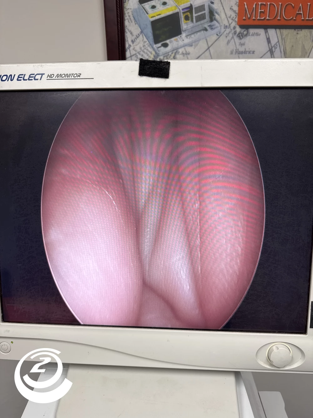 KARL STORZ Hopkins II 27005 BA