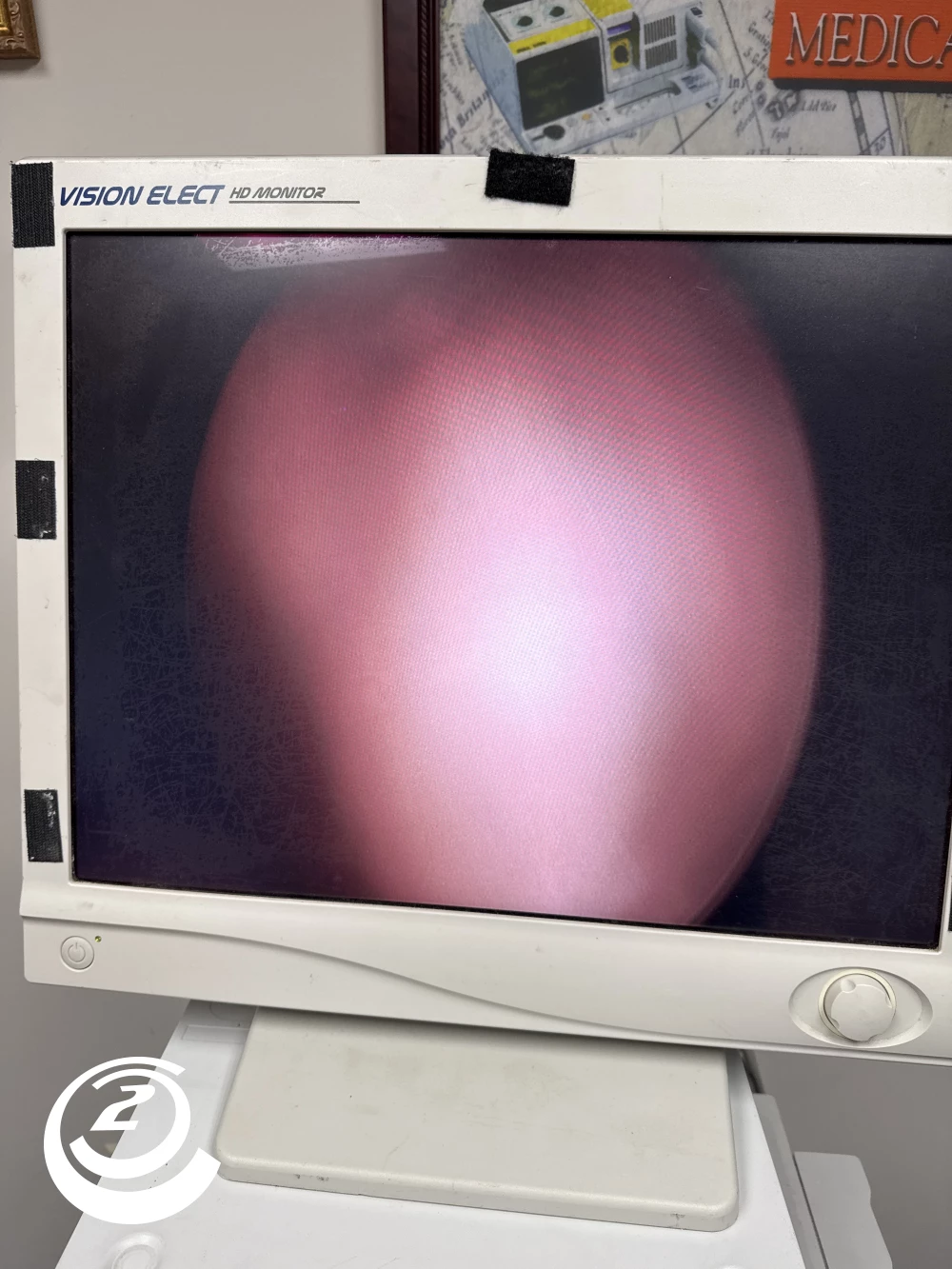 KARL STORZ Hopkins II 27005 BA